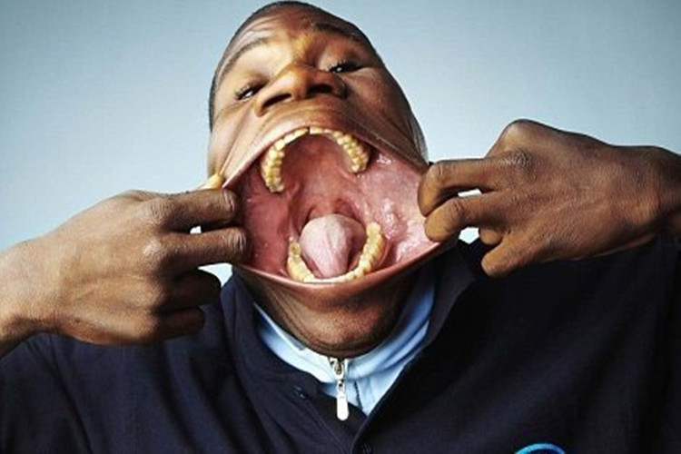 世界第一大嘴男，嘴巴长达17厘米(能吞208只筷子)