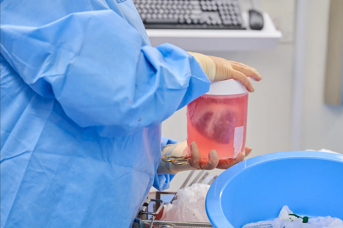 基因工程猪心脏被成功移植到死人身上并连上呼吸机