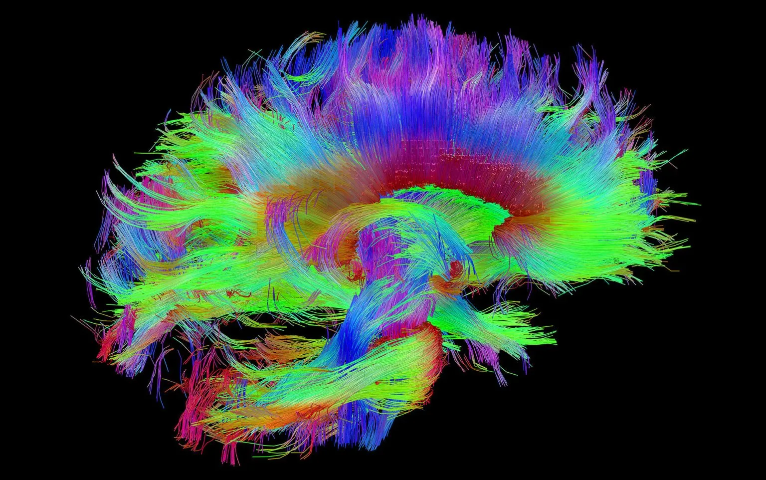 科学家创建了最详细的大脑记忆中心地图 它可能改变我们对记忆的理解